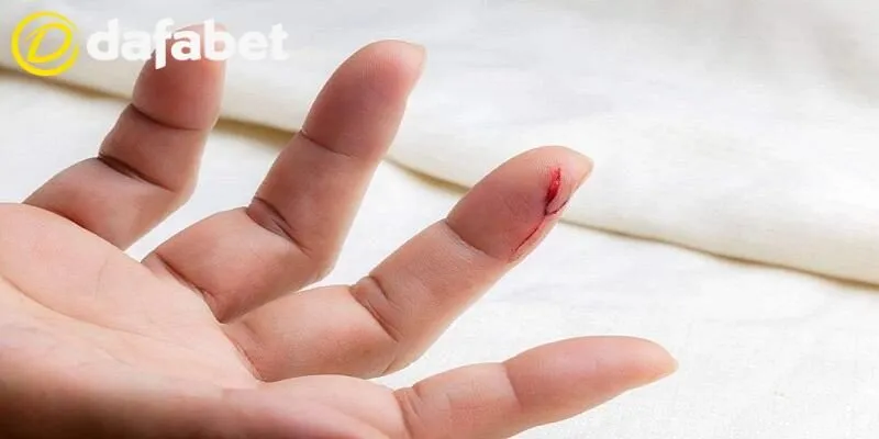 Mơ Thấy Máu Đánh Con Gì Tại Dafabet - Giải Mã Điềm Báo 4 Mơ thấy máu đánh con gì để thử vận may tại Dafabet