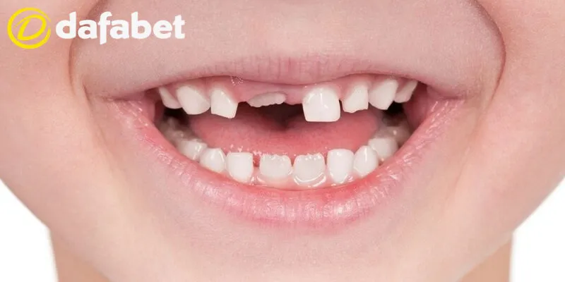 Giải Mã Nằm Mơ Thấy Răng Rụng – Điềm Báo Gì? Nên Đánh Con Số Mấy? 4 Hầu như giấc mơ về răng rụng đều có một điềm báo không được may mắn